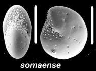 Elphidium somaense Takayanagi 1955, unsequenced specimen, South Korea,