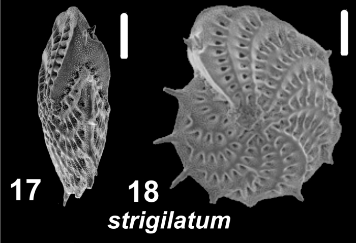 Elphidium strigilatum (Fichtel and Moll 1798), S10, sequenced specimen,