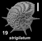 Elphidium strigilatum (Fichtel and Moll 1798), S10, sequenced juvenile specimen