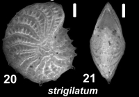 Elphidium strigilatum (Fichtel and Moll 1798), unsequenced specimen, FEU 1015961, United Kingdom