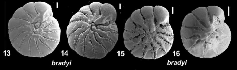 Ammonia bradyi Billman, Hottinger and Osterle 1980, T24, identified specimens