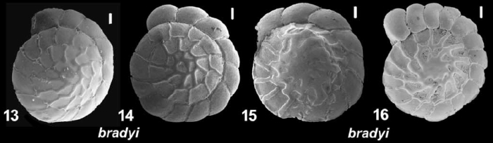 Ammonia bradyi Billman, Hottinger and Osterle 1980, T24,
