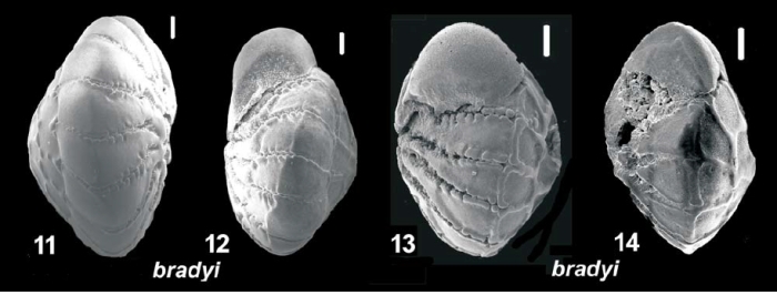 Ammonia bradyi Billman, Hottinger and Osterle 1980, T24,