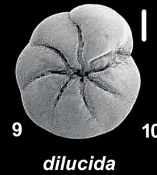 Ammonia dilucida Shchedrina 1984, unsequenced specimen, Palau