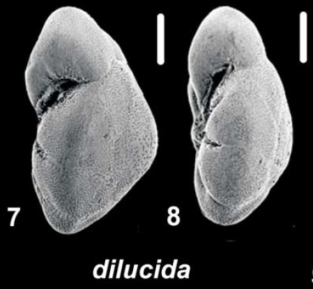 Ammonia dilucida Shchedrina 1984, unsequenced specimen, Palau