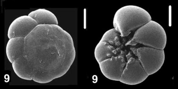 Ammonia hattai Hayward and Holzmann, 2021, unsequenced specimen,