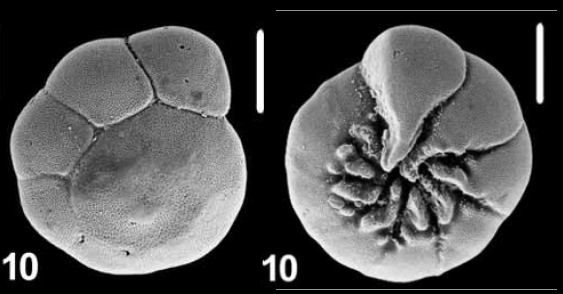 Ammonia hattai Hayward and Holzmann, 2021, unsequenced specimen, Malaysia