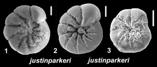 Ammonia justinparkeri Hayward and Holzmann, 2021, paratype and unsequenced specimens