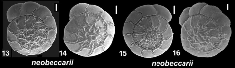 Ammonia neobeccarii Shchedrina and Mayer 1975, unsequenced specimens