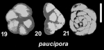 Ammonia paucipora Zheng 1979, holotype
