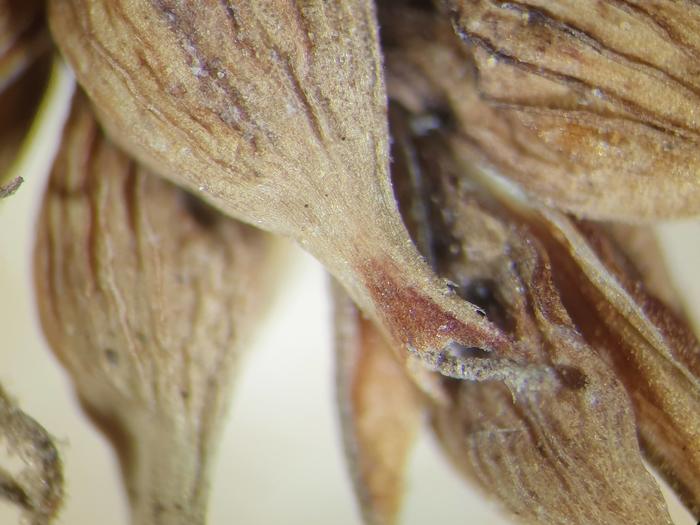 Photo of isotype 04322360 at NY