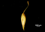 Utricle (abaxial) of Carex hamata US02544571