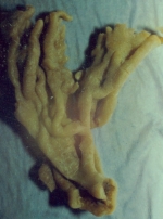 Hymeniacidon agminata Ridley, 1884 type