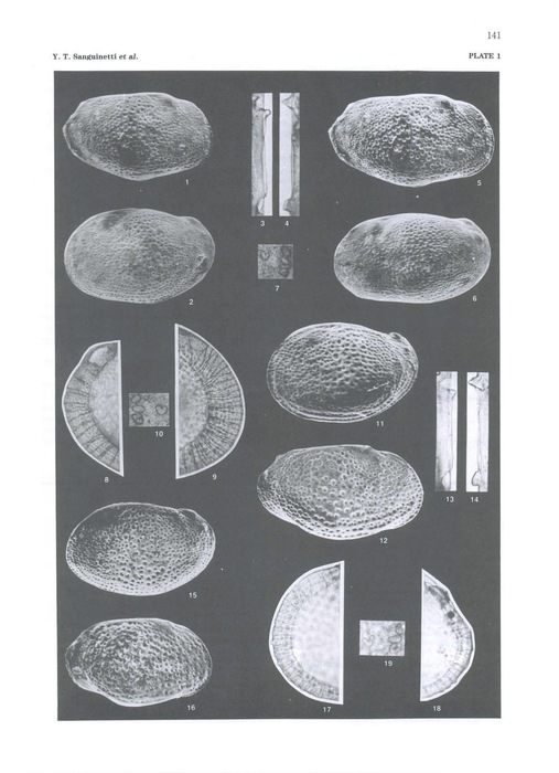 Argenticytheretta laevipunctata Sanguinetti, Ornellas &amp; Coimbra, 1991 and Argenticytheretta variabilis Sanguinetti, Ornellas &amp; Coimbra, 1991 from the original description