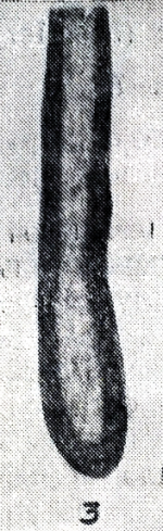 Hyperammina moderata Malakhova, 1954