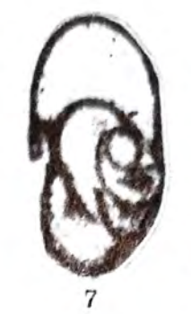 Globivalvulina arguta Konovalova, 1962