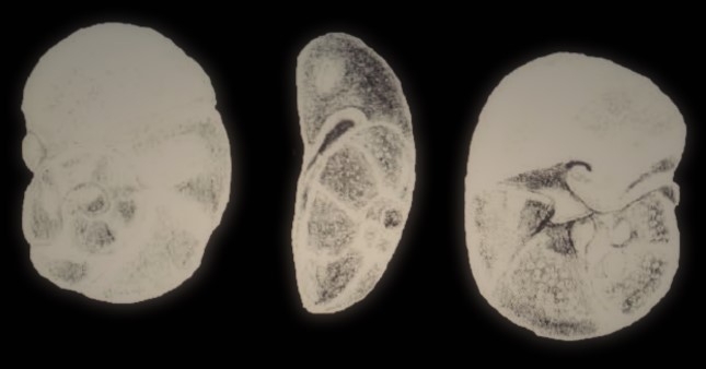 Pararosalina (?) bretonensis McCulloch, 1981