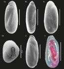 Pseudolachlanella slitella from Brazilian continental margin (scale bar = 100μm)