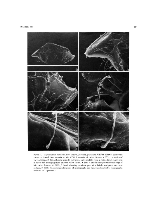 Angulorostrum monothrix Kornicker, 1981 from the original description