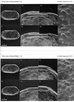 Rockallia enigmatica  Whatley, Frame & Whittaker, 1978 from the original description