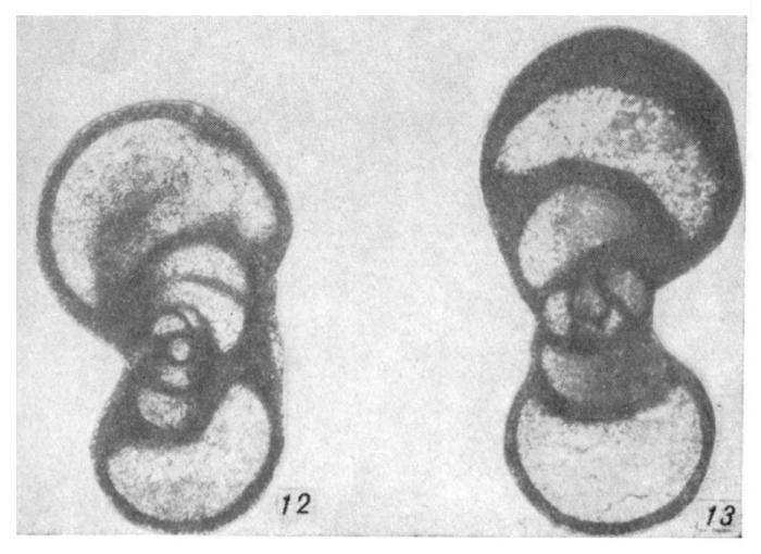 Endothyra tatianae Ganelina, 1956