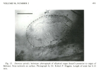 Deeveya spiralis Kornicker & Iliffe, 1985 from the original description
