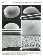 Deeveya spiralis Kornicker & Iliffe, 1985 from the original description