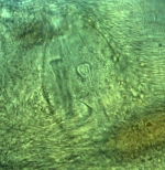 Holotype