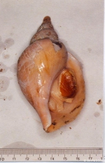 Caenogastropoda