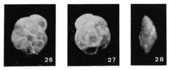 Asterigerinata stellata Margerel, 1968
