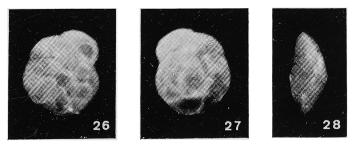 Asterigerinata stellata Margerel, 1968