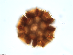 Pollen grain of Baccharoides benguellensis, Pereira, L. 1421