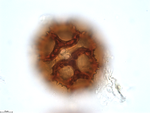 Pollen grain of Baccharoides benguellensis, Pereira, L. 1421