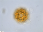 Pollen grain of Bothriocline aggregata, Gossweiler, J., LISU58725