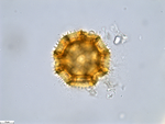 Pollen grain of Bothriocline aggregata, Gossweiler, J., LISU58725