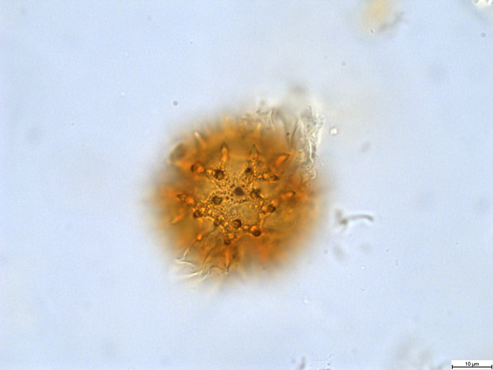 Pollen grain of Bothriocline attenuata, LeJoly, 84/810