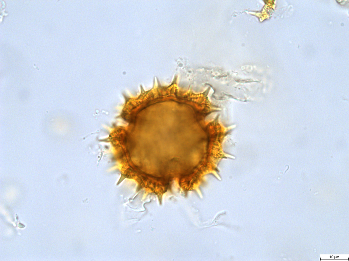 Pollen grain of Bothriocline attenuata, LeJoly, 84/810