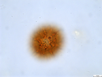 Pollen grain of Bothriocline attenuata, LeJoly, 84/810