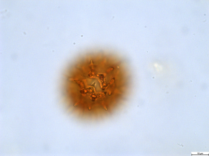 Pollen grain of Bothriocline attenuata, LeJoly, 84/810
