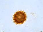 Pollen grain of Bothriocline attenuata, LeJoly, 84/810