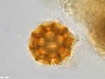 Pollen grain of Bothriocline carrissoi, Borges, A. 68