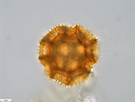 Pollen grain of Bothriocline carrissoi, Borges, A. 68