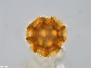 Pollen grain of Bothriocline carrissoi, Borges, A. 68