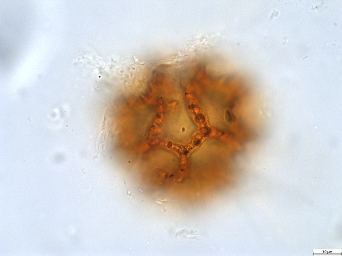 Pollen grain of Bothriocline grandicapitulata, Duvigneaud, 5104 B1