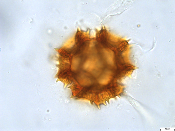 Pollen grain of Bothriocline grandicapitulata, Duvigneaud, 5104 B1