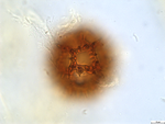 Pollen grain of Bothriocline grandicapitulata, Duvigneaud, 5104 B1