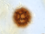 Pollen grain of Bothriocline grandicapitulata, Duvigneaud, 5104 B1