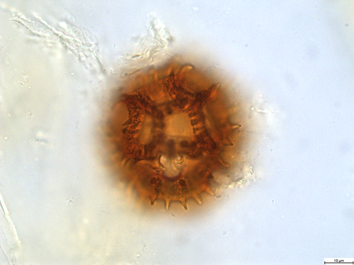 Pollen grain of Bothriocline grandicapitulata, Duvigneaud, 5104 B1