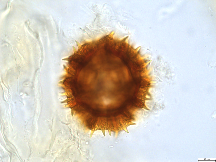 Pollen grain of Bothriocline grandicapitulata, Duvigneaud, 5104 B1