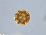 Pollen grain of Bothriocline moramballae, Torre, A.R.; Correia, M.F., 16420